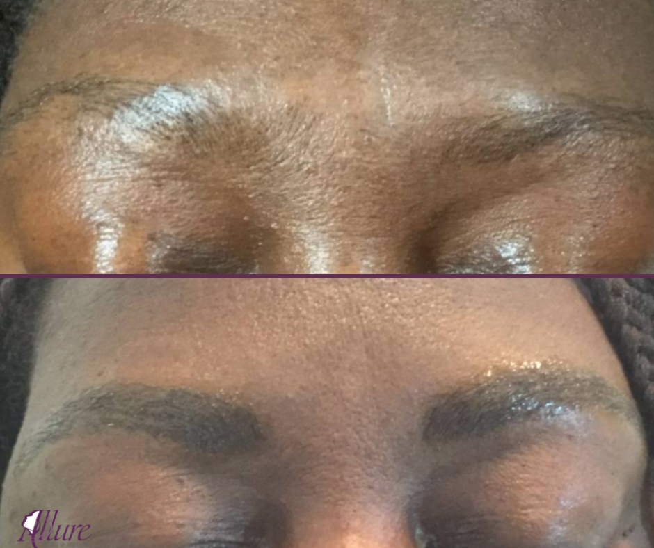 To Crystal Clear (Replacement) -  Microblading