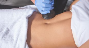 Your Laser Liposuction Recovery Guide